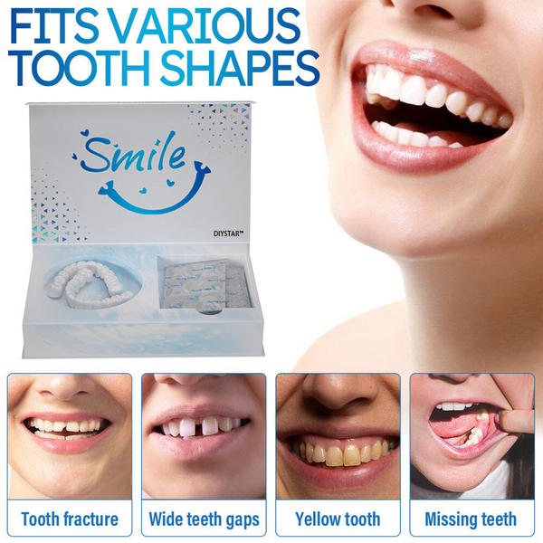 Instant Smile Veneers | Removable Cosmetic Dental Veneers | Natural White, Comfortable & Universal Fit
